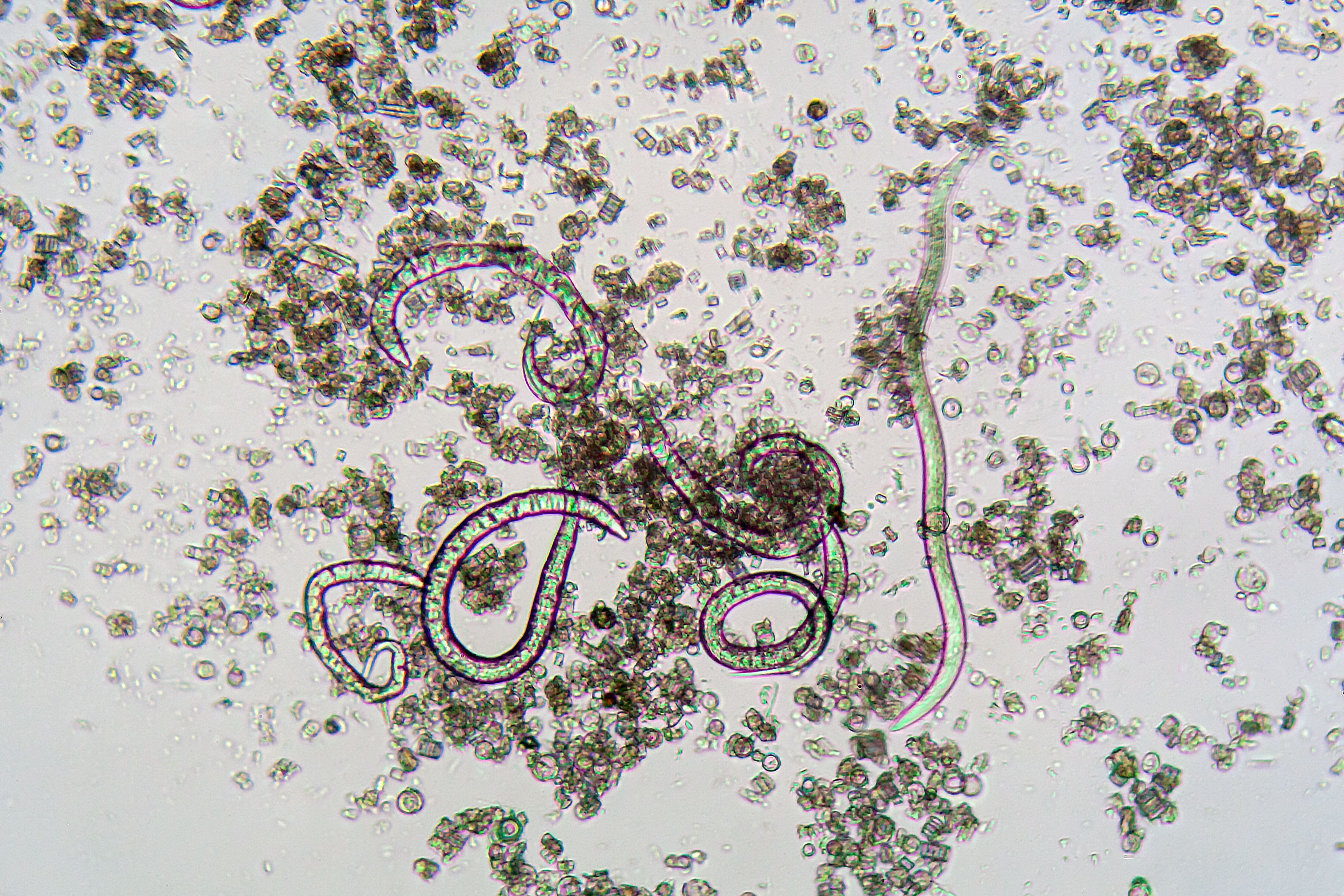 Nematoden (Steinernema feltiae) unter dem Mikroskop